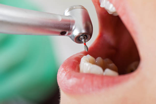 Best Emergency Broken Tooth Repair in Clive, IA